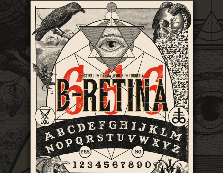 B-Retina